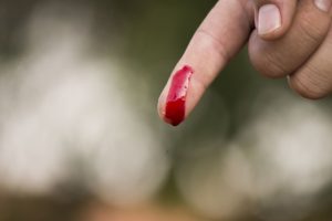 Blut am Finger